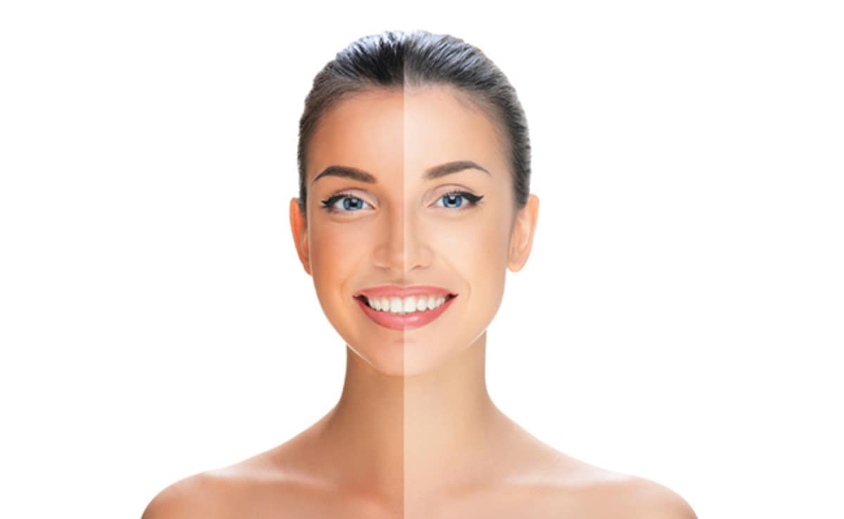 धूप से टैन हो गया है चेहरा? इन घरेलू चीजों का करें इस्तेमाल, मिलेगा चंद सा निखार...