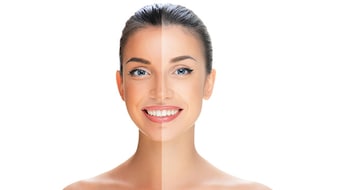 धूप से टैन हो गया है चेहरा? इन घरेलू चीजों का करें इस्तेमाल, मिलेगा चंद सा निखार...