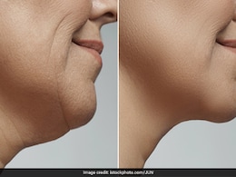 कम उम्र में ही झुर्रियों की वजह से ढ़ीली हो गई है स्किन तो करें ये योगासन, महीनेभर में झुर्रियां और फाइन लाइन्स हो जाएंगी गायब