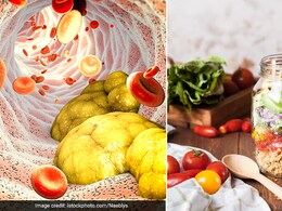 Herbs You Should Eat To Remove Cholestrol Blockages Herbs You Should Eat To Remove Cholestrol Blockages