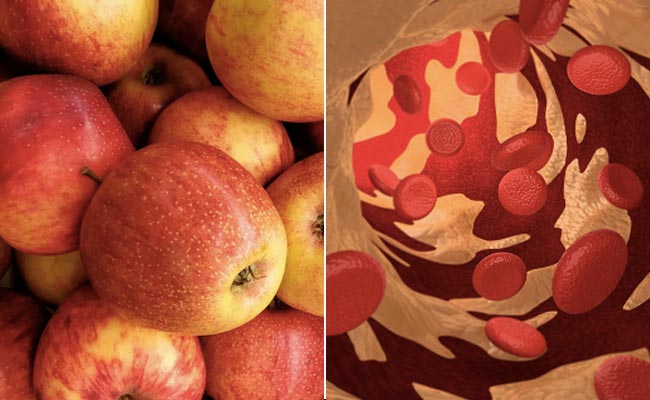 Apple Benefits: बैड कोलेस्ट्रॉल को कम कर सकता है सेब, जानें किस तरह खाने पर मिलते हैं फायदे 