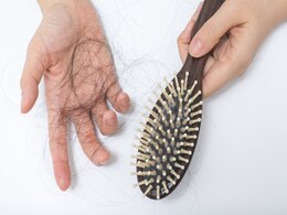 Hair fall reason : खान पान की इन 4 गलतियों की वजह से बाल लगते हैं झड़ने, तो अब से लाइए डाइट में सुधार Hair fall reason : खान पान की इन 4 गलतियों की वजह से बाल लगते हैं झड़ने, तो अब से लाइए डाइट में सुधार