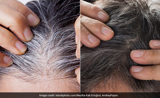 White Hair को काला करने के नारियल तेल में मिलाकर लगा लें ये चीज, रातोंरात जड़ों से काले हो जाएंगे बाल White Hair को काला करने के नारियल तेल में मिलाकर लगा लें ये चीज, रातोंरात जड़ों से काले हो जाएंगे बाल