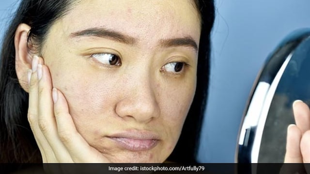 Certain fruits and vegetables may be too harsh if applied directly onto the skin