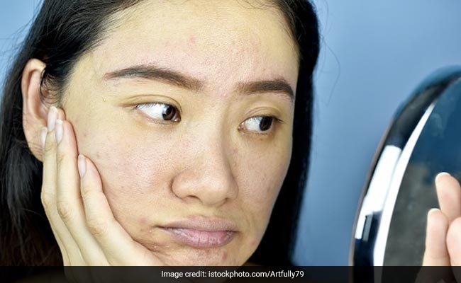 Certain fruits and vegetables may be too harsh if applied directly onto the skin