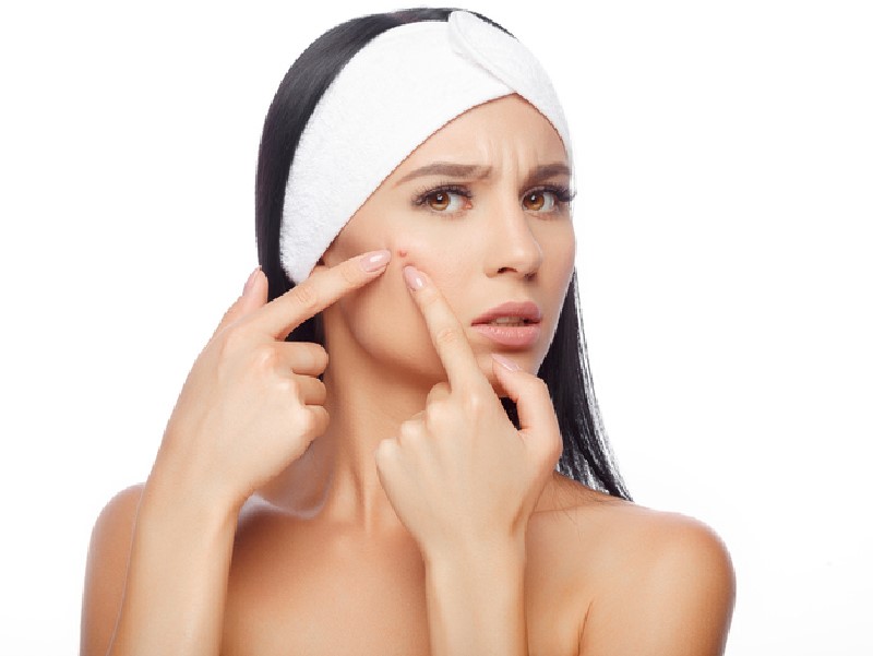 A Complete Guide On How To Take Care Of Acne-Prone Skin