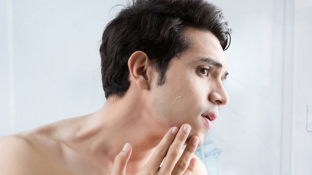 Do men need to take care of their skin?