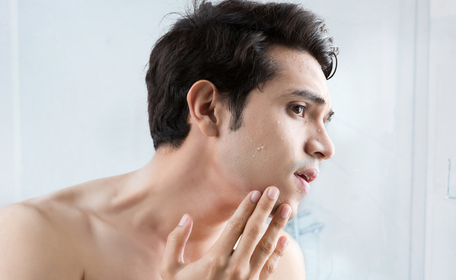 Do men need to take care of their skin?