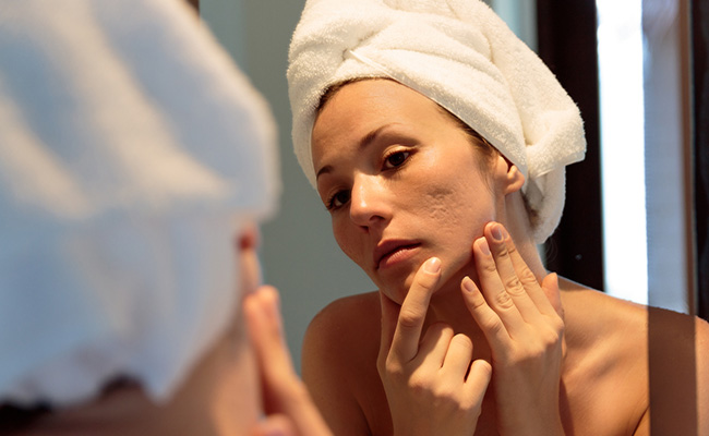 What you eat shows on your skin, so eat healthy