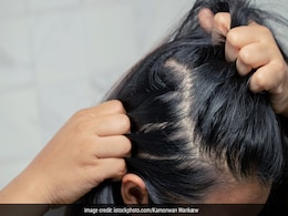 बालों को जड़ से मजबूत बनाता है यह मसाला, हफ्ते में 2 बार लगाने पर ही तेजी से बढ़ने लगेंगे बाल बालों को जड़ से मजबूत बनाता है यह मसाला, हफ्ते में 2 बार लगाने पर ही तेजी से बढ़ने लगेंगे बाल