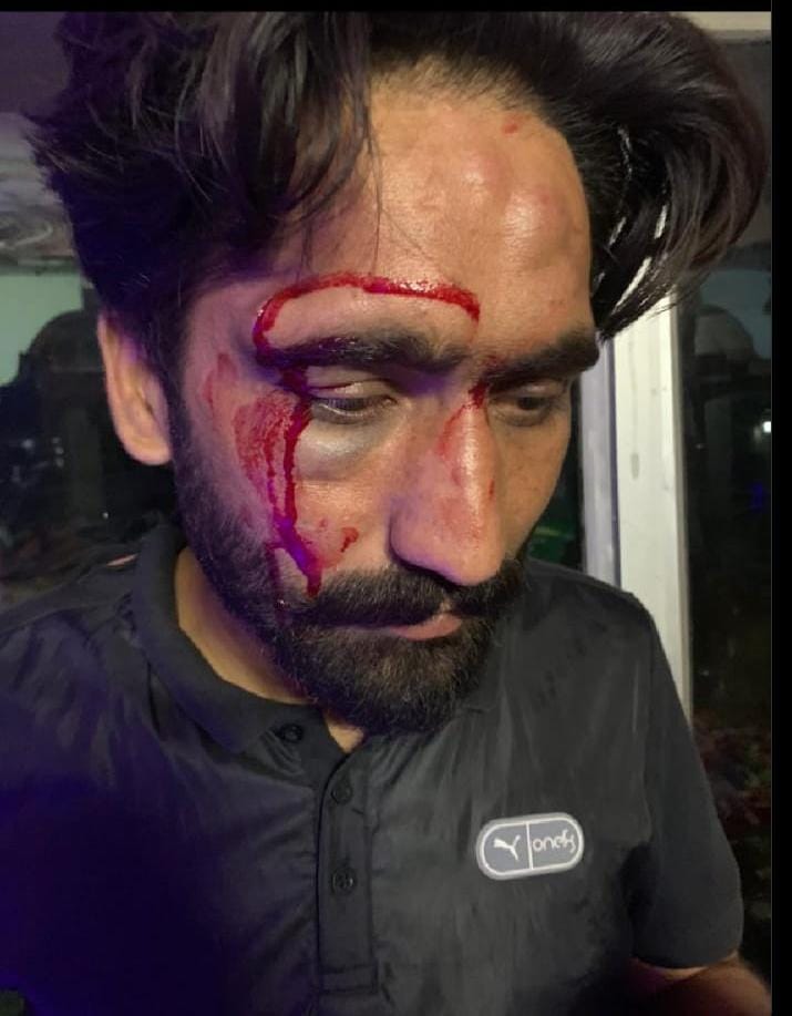 Witness In UP Farmers' Killing Alleges Attack Over Case, Cops Deny Charge