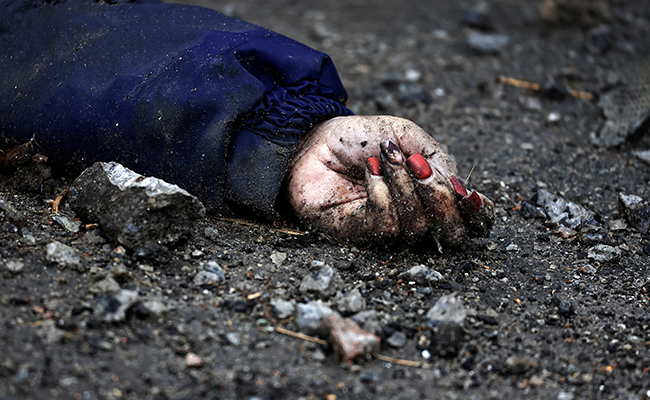 Chilling Photo Of Hand In Ukraine Went Viral. Someone Recognised Manicure