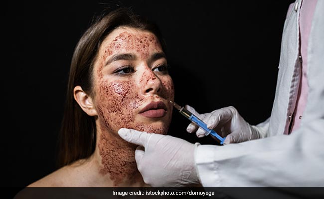 Vampire facial से चेहरे पर नहीं दिखेगा बढ़ती उम्र का असर, इस ट्रीटमेंट में खर्च होंगे बस इतने रुपये