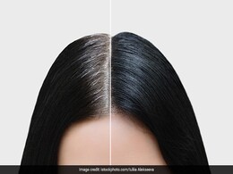 How To Black White Hair: क्या आप जानते हैं बालों को सफेद होने से रोकने की तरकीब? यहां 7 प्रभावी घरेलू ट्रिक्स हैं How To Black White Hair: क्या आप जानते हैं बालों को सफेद होने से रोकने की तरकीब? यहां 7 प्रभावी घरेलू ट्रिक्स हैं