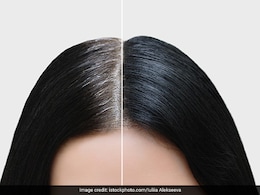 सफेद बालों को हमेशा के लिए काला कर देंगी किचन में मौजूद ये 2 चीजें, करोड़ों में एक है ये नुस्खा ! सफेद बालों को हमेशा के लिए काला कर देंगी किचन में मौजूद ये 2 चीजें, करोड़ों में एक है ये नुस्खा !