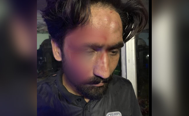 Witness In UP Farmers' Killing Alleges Attack Over Case, Cops Deny Charge