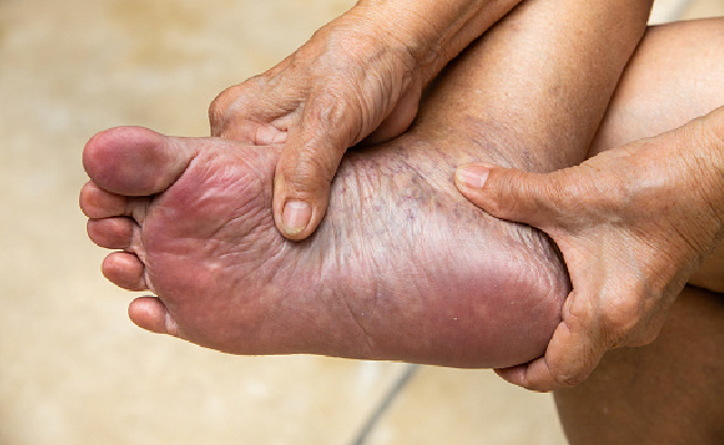Massaging the affected joints with warm mustard oil can help reduce inflammation