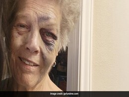 Carjacker Attacks 72-Year-Old Woman In US, Takes Her Car, But Dies In Crash Carjacker Attacks 72-Year-Old Woman In US, Takes Her Car, But Dies In Crash