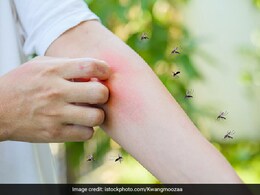 शरीर पर नहीं लगाने होंगे मच्छर भगाने वाले हार्मफुल केमिकल, बच्चे-बुजुर्ग भी रहेंगे सेफ, अपनाएं ये तरीका शरीर पर नहीं लगाने होंगे मच्छर भगाने वाले हार्मफुल केमिकल, बच्चे-बुजुर्ग भी रहेंगे सेफ, अपनाएं ये तरीका