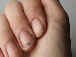 नाखूनों की गंदगी और पीलेपन को दूर करते हैं ये 7 उपाय, दिखेगा तुरंत असर  नाखूनों की गंदगी और पीलेपन को दूर करते हैं ये 7 उपाय, दिखेगा तुरंत असर