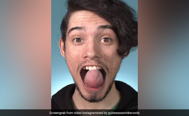 US Man Sets World Record For Tongue As Big As A "Ping Pong Ball"