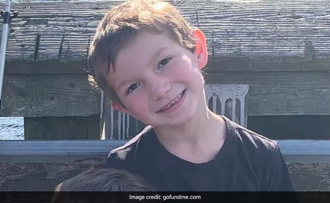 "पड़ोसी ने 6 साल के बच्चे पर फेंकी जलती गेंद"...अस्पताल में बच्चा, परिवार ने मांगी मदद