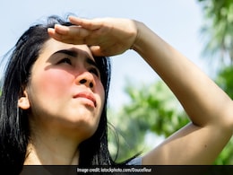 Sunburn का असर दिखने लगा है चेहरे पर तो तुरंत आजमाएं ये 4 उपाय, धूप से जलन होगी कम  Sunburn का असर दिखने लगा है चेहरे पर तो तुरंत आजमाएं ये 4 उपाय, धूप से जलन होगी कम