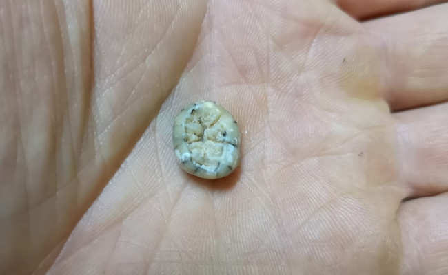 Child's Tooth, 1,30,000 Years Old, Offers Clues To Ancient Human Relative