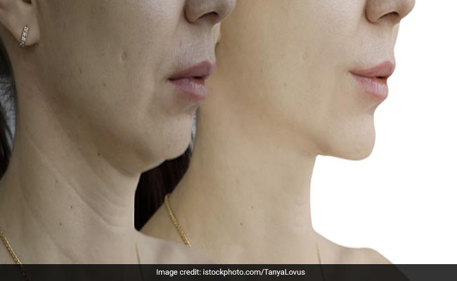 50 की उम्र में दिखना है 25 का तो रोजाना खाएं ये 4 फल, हर कोई पूछेगा आपकी कम उम्र का राज