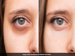 Dark Circle Remedies: आंखों के नीचे काले घेरों को गायब करने के लिए 6 सिम्पल DIY, कुछ ही दिनों में दिखेगा इफेक्ट Dark Circle Remedies: आंखों के नीचे काले घेरों को गायब करने के लिए 6 सिम्पल DIY, कुछ ही दिनों में दिखेगा इफेक्ट