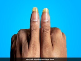 नाखून की सेहत अगर गई है बिगड़ तो हो जाइए अलर्ट, किसी गंभीर बीमारी का है संकेत ! नाखून की सेहत अगर गई है बिगड़ तो हो जाइए अलर्ट, किसी गंभीर बीमारी का है संकेत !