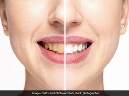 Homemade Tooth Powder: हीरे जैसे चमकदार और लौहे जितने मजबूत दांत पाने के लिए घर पर ऐसे बनाएं अपना ऑर्गेनिक टूथ पाउडर