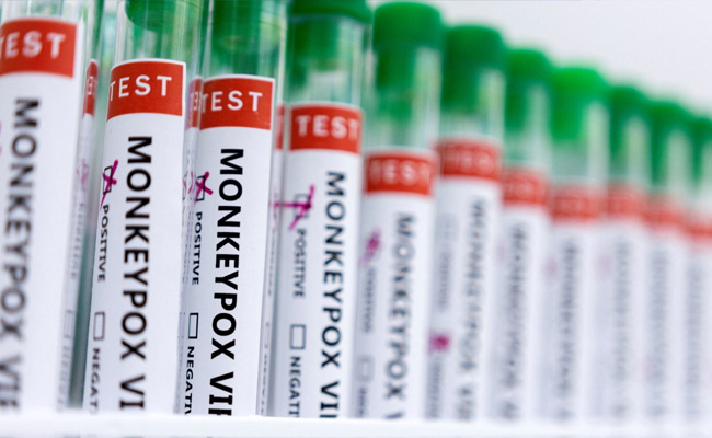Suspected Case Of Monkeypox Found In Telangana