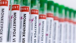 World Monkeypox Outbreak Tops 50,000 Cases: WHO