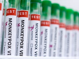 World Monkeypox Outbreak Tops 50,000 Cases: WHO World Monkeypox Outbreak Tops 50,000 Cases: WHO