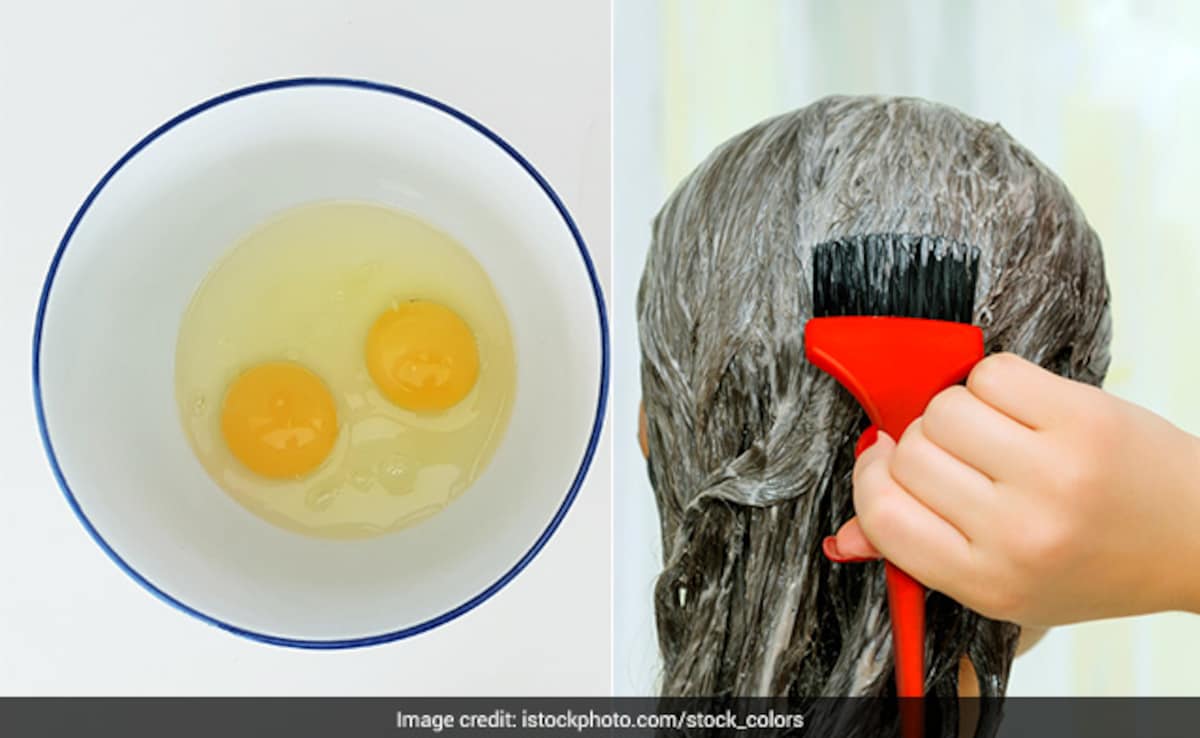 Add image caption here Add image caption here