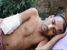 बच्चे के यौन शोषण के आरोप में शख्स का हाथ काट दिया गया था; अदालत ने किया बरी, कही यह बात बच्चे के यौन शोषण के आरोप में शख्स का हाथ काट दिया गया था; अदालत ने किया बरी, कही यह बात