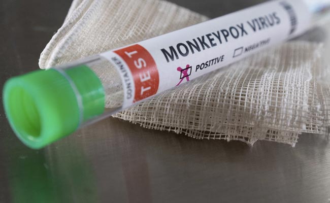 Nepal Reports Suspected Case Of Monkeypox: Report
