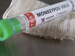 Monkeypox Outbreak Can Be Contained, Says White House