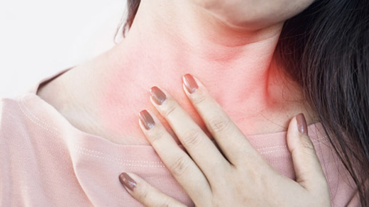 Chemical Burn शरीर पर गिर जाए एसिड तो सबसे पहले क्या करें? फर्स्ट एड के इन तरीकों से जल्द