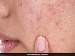 Skin Care: चेहरे पर इन 5 चीजों को लगाने की नहीं करनी चाहिए भूल, त्वचा हो सकती है खराब  Skin Care: चेहरे पर इन 5 चीजों को लगाने की नहीं करनी चाहिए भूल, त्वचा हो सकती है खराब