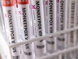 UAE Reports 3 More Monkeypox Cases UAE Reports 3 More Monkeypox Cases
