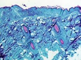 Monkeypox Timeline: From Beginnings In Africa To Global Spread Monkeypox Timeline: From Beginnings In Africa To Global Spread