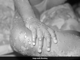 Monkeypox: क्या चेचक की तरह है मंकीपॉक्स? यहां इस खतरनाक वायरस के बारे में वह सब कुछ है जो आपको जानना चाहिए Monkeypox: क्या चेचक की तरह है मंकीपॉक्स? यहां इस खतरनाक वायरस के बारे में वह सब कुछ है जो आपको जानना चाहिए