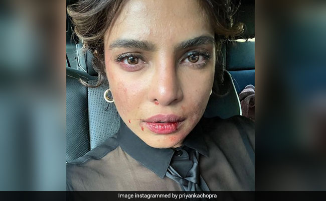 Priyanka Chopra's Latest Pic From Sets Of <i>Citadel</i> Is Not For The Faint-Hearted