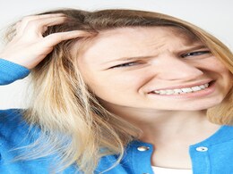 Scalp में रहती है खुजली, अपनाएं ये आसान घरेलू नुस्खे जल्द मिलेगी राहत Scalp में रहती है खुजली, अपनाएं ये आसान घरेलू नुस्खे जल्द मिलेगी राहत