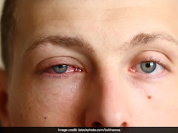 आंख आने वालों की आंख में देखने से नहीं फैलती है कंजंक्टिवाइटिस, एक्सपर्ट से जानिए आंख आने की सही वजह आंख आने वालों की आंख में देखने से नहीं फैलती है कंजंक्टिवाइटिस, एक्सपर्ट से जानिए आंख आने की सही वजह