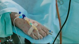 Is Monkeypox Global Health Emergency? WHO Experts Split On Decision: Report