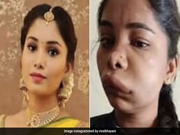 रूट कनाल सर्जरी के लिए गईं कन्नड़ एक्ट्रेस Swathi Sathish का बिगड़ा चेहरा, जानिए कहां हुई गलती, क्या है रूट कैनाल सर्जरी और किन बातों का रखें ध्यान रूट कनाल सर्जरी के लिए गईं कन्नड़ एक्ट्रेस Swathi Sathish का बिगड़ा चेहरा, जानिए कहां हुई गलती, क्या है रूट कैनाल सर्जरी और किन बातों का रखें ध्यान