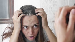 Tips To Get Rid Of Premature Greying Of Hair